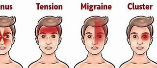 Sakit Kepala Bagian Depan Kening